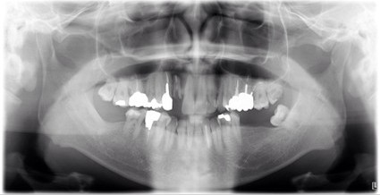 お年寄りの夫婦