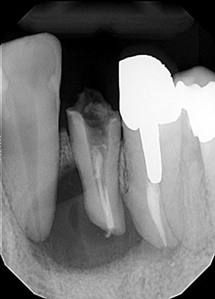 マイクロスコープ