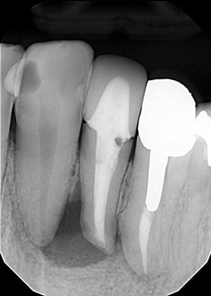 マイクロスコープ