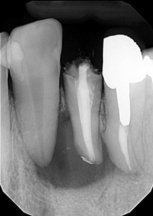 お年寄りの夫婦