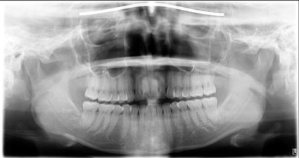 マイクロスコープ