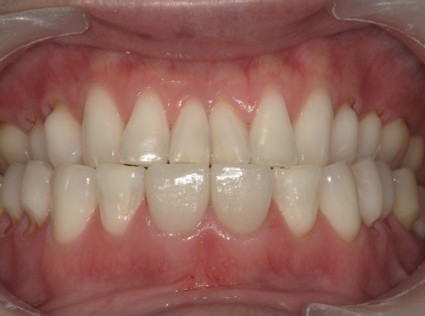 お年寄りの夫婦