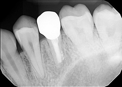 お年寄りの夫婦