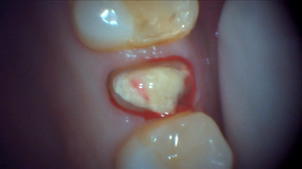 マイクロスコープ