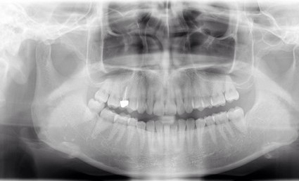 マイクロスコープ