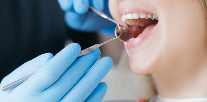 歯石取りの前の口腔チェックの様子