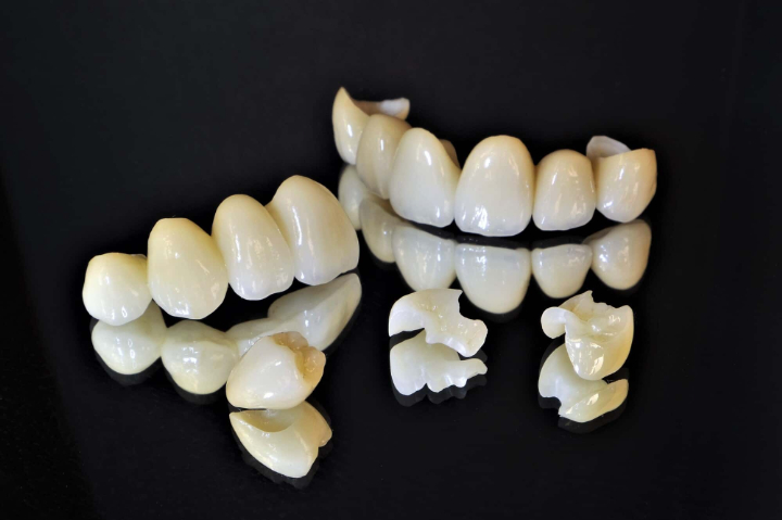 セラミック歯のイメージ