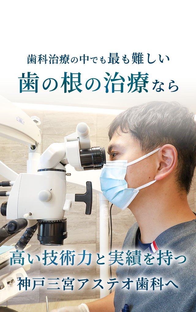 三ノ宮で根管治療（歯根治療）なら神戸三宮アステオ歯科へ