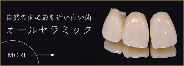 オールセラミック
