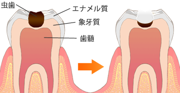 ステップ：1