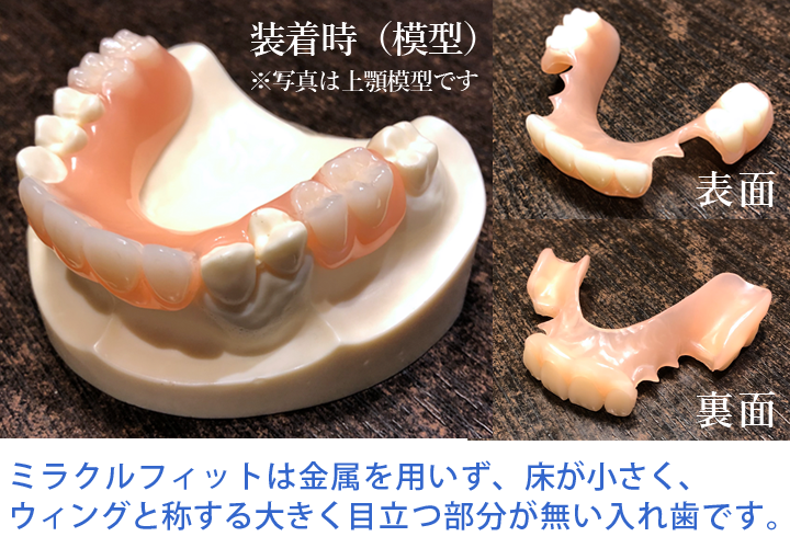 ミラクルフィット