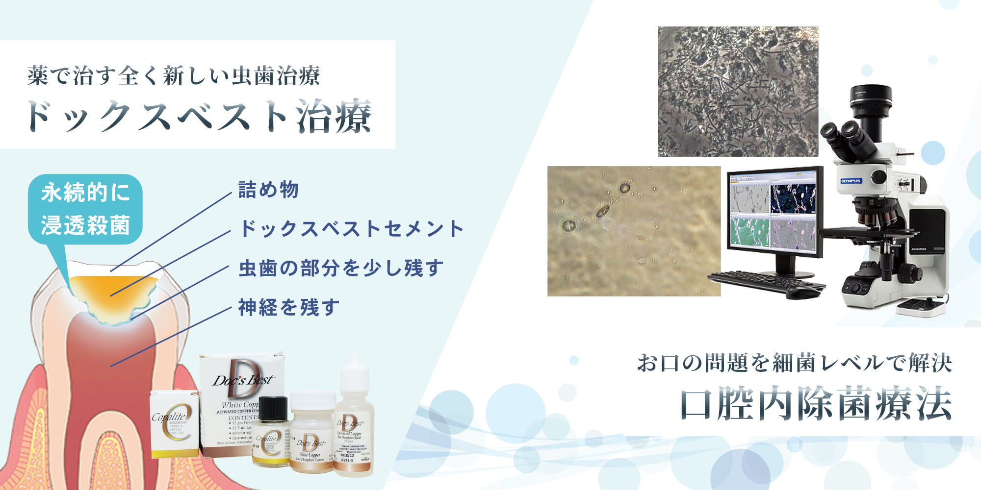 三宮 ドックスベスト治療・口腔内除菌療法