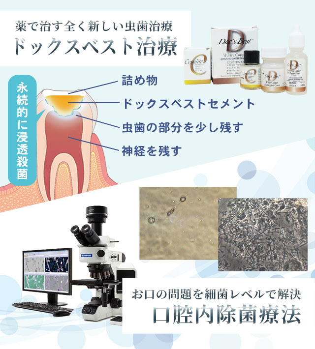 三宮 ドックスベスト治療・口腔内除菌療法