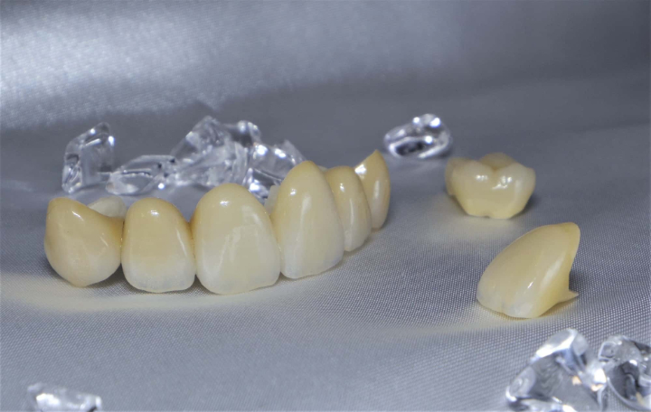 セラミックの歯のイメージ