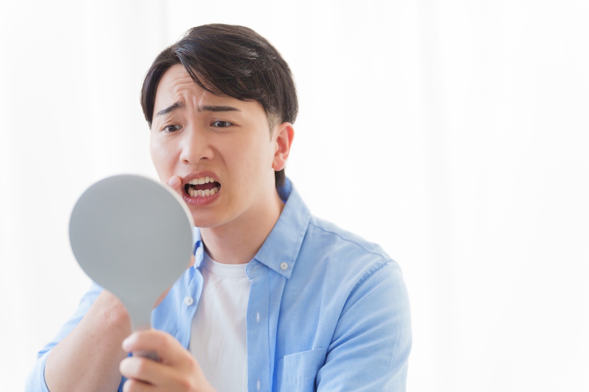 根管治療中の仮蓋が取れて鏡で歯を確認している男性